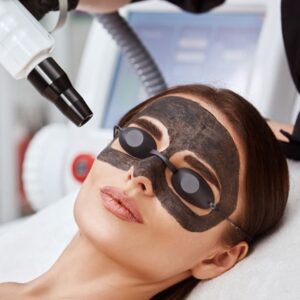 Carbon Laser Peeling