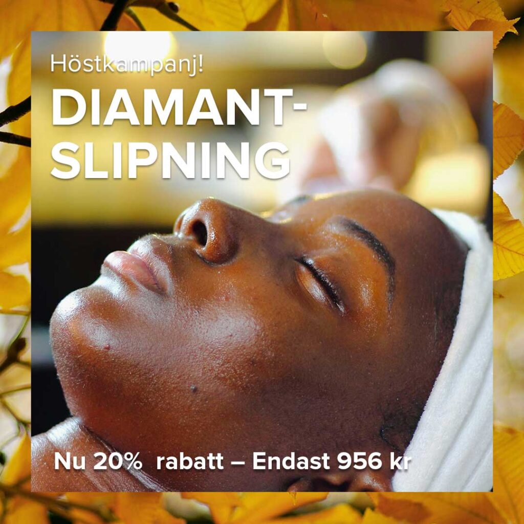 Kampanj Diamantslipning Ansikte