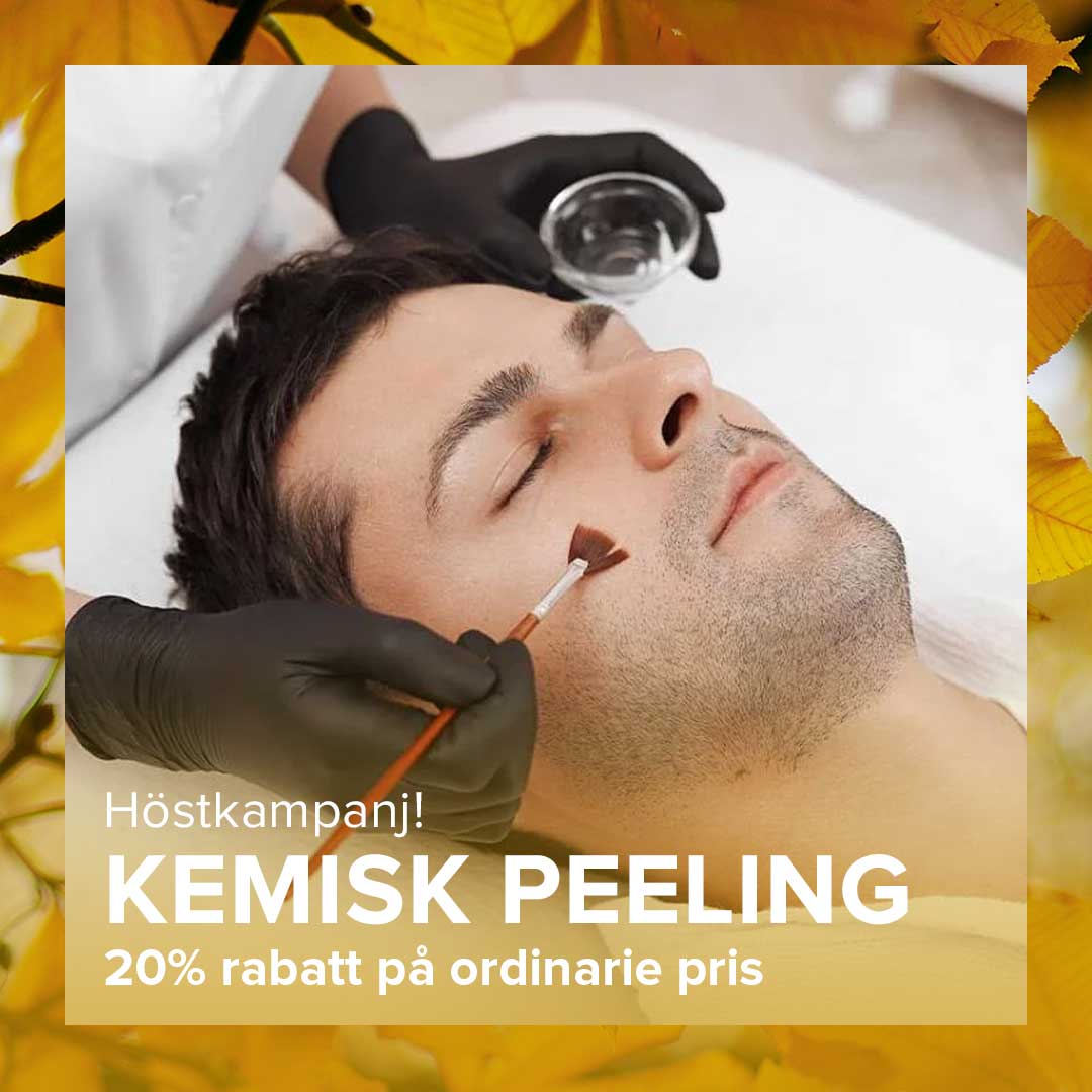Erbjudande på kemisk peelingbehandling i ansiktet