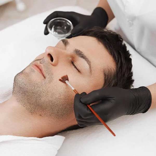 Ansiktsbehandling med kemisk peeling