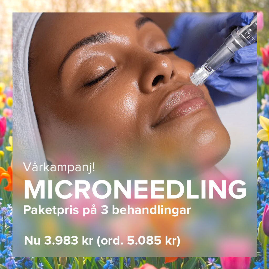 Vårkampanj på microneedling
