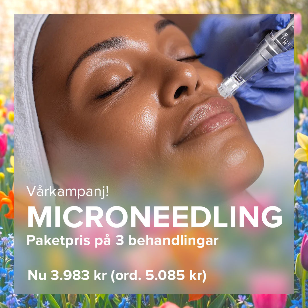 Vårkampanj på microneedling