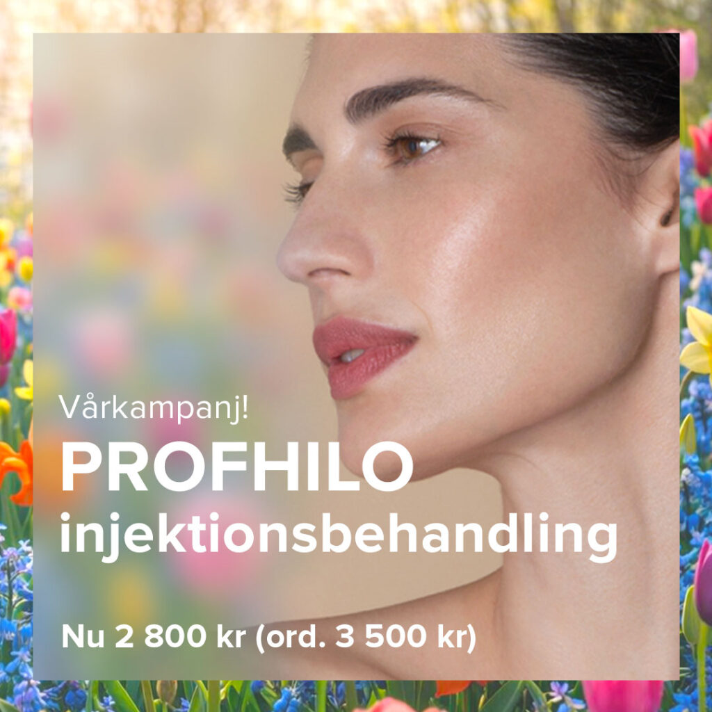 Vårkampanj på profhilo hudvårdsbehandling