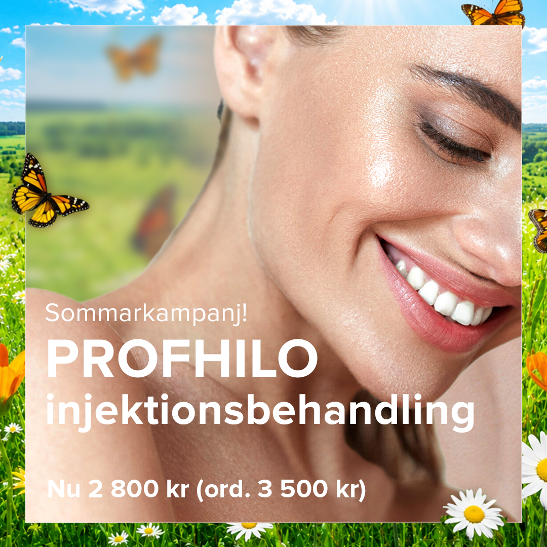 Sommarkampanj på Profhilo ansiktsbehandling. Nu 20% rabatt